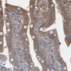 Anti-GDPD3 Antibody