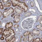 Anti-GDPD3 Antibody