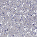 Anti-GDPD3 Antibody