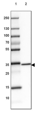 Anti-GDPD3 Antibody