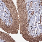 Anti-TELO2 Antibody