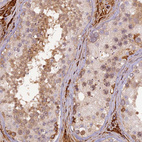 Anti-PZP Antibody