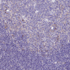 Anti-PZP Antibody