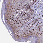 Immunohistochemical staining of human Skin shows strong nuclear and cytoplasmic positivity in squamous epithelial cells.