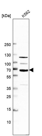 Western blot analysis in human cell line K562.