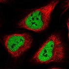 Immunofluorescent staining of human cell line U-2 OS shows localization to nucleoplasm.