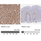 Anti-PRDX3 Antibody