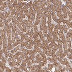 Anti-PRDX3 Antibody