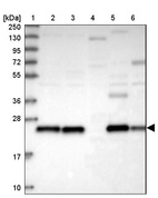 Anti-PRDX3 Antibody