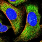 Anti-PPP1R37 Antibody