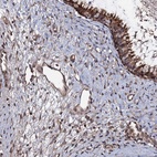 Anti-KXD1 Antibody