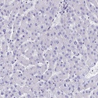 Anti-SEPT1 Antibody