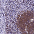 Anti-SEPT1 Antibody