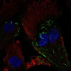 Anti-GUCA1C Antibody