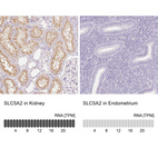 Anti-SLC5A2 Antibody