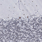 Immunohistochemical staining of human cerebellum shows moderate to strong nuclear positivity in Purkinje cells.