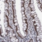 Immunohistochemical staining of human small intestine shows moderate to strong nuclear positivity in glandular cells.