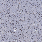 Anti-HNRNPUL2 Antibody