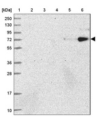 Lane 1: Marker [kDa] 250, 130, 95, 72, 55, 36, 28, 17, 10_br/_Lane 2: Human cell line RT-4_br/_Lane 3: Human cell line U-251MG sp_br/_Lane 4: Human plasma (IgG/HSA depleted)_br/_Lane 5: Human liver tissue_br/_Lane 6: Human tonsil tissue