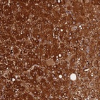 Anti-FAM118B Antibody