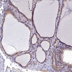 Anti-RABGAP1 Antibody