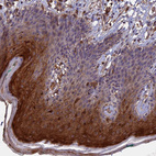 Anti-RASAL1 Antibody