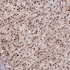 Anti-CHST12 Antibody