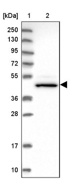 Anti-CHST12 Antibody