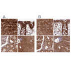 Anti-TCF25 Antibody