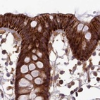 Anti-TCF25 Antibody