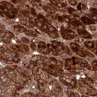 Anti-TCF25 Antibody