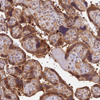 Anti-ARHGAP17 Antibody