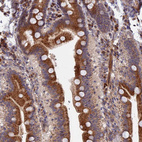 Anti-TRAPPC2L Antibody