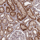 Anti-TRAPPC2L Antibody