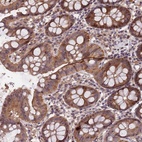 Anti-CCDC184 Antibody