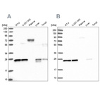 Anti-MESDC2 Antibody