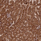 Anti-CORO1C Antibody