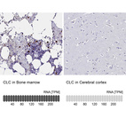 Anti-CLC Antibody