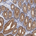 Immunohistochemical staining of human stomach shows strong membranous positivity in glandular cells.