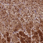 Anti-CCSER1 Antibody