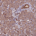 Anti-ZNF598 Antibody