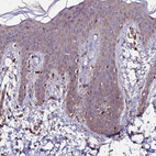 Anti-ZNF598 Antibody