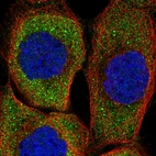 Anti-ZNF598 Antibody