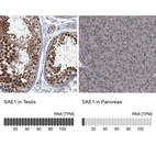 Anti-SAE1 Antibody