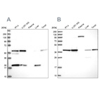 Anti-SAE1 Antibody