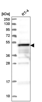 Anti-ZFYVE19 Antibody