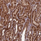 Anti-CCDC8 Antibody