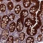 Anti-DCTN5 Antibody