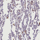 Anti-CCL23 Antibody