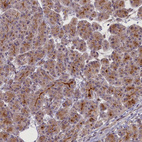 Anti-CCL23 Antibody